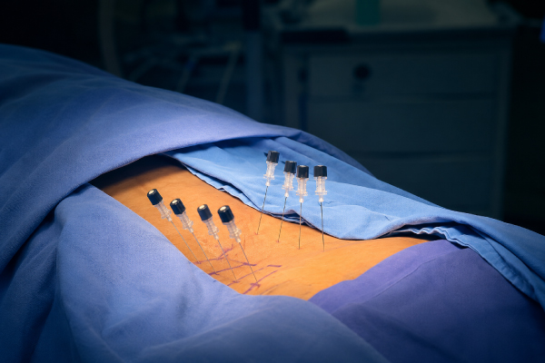 Tratamentos para coluna vertebral